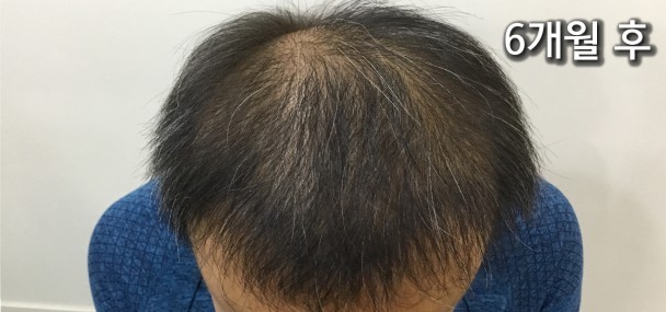 6개월후